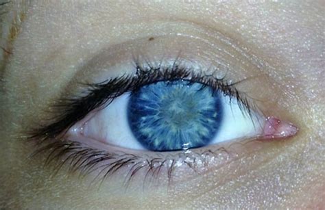 [E.O.M.S.]: Eyes Without Pupils