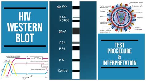 HIV western blot | SDS gel | procedure | Interpretation | #pathology # ...