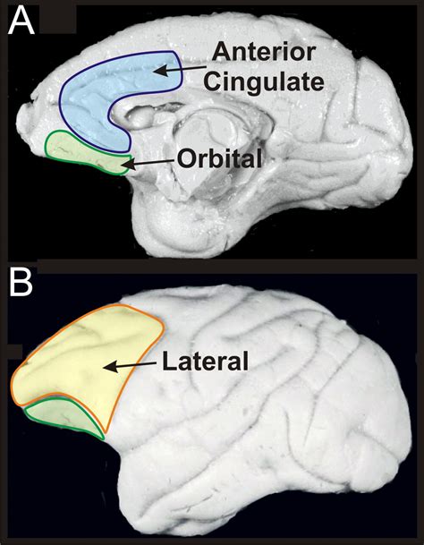 Functional Specialization of the Primate Frontal Cortex during Decision Making | Journal of ...