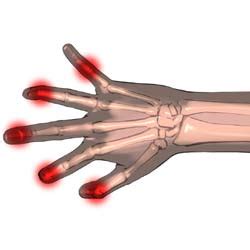 Finger Joint Pain - Symptoms, Causes, Treatments & More