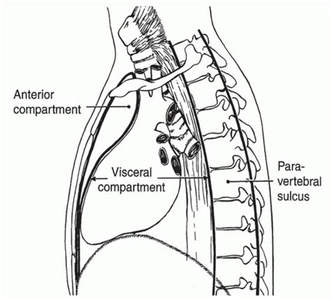 Diagnostic Evaluation of Anterior Mediastinal Masses and Clinical and Surgical Approach to ...