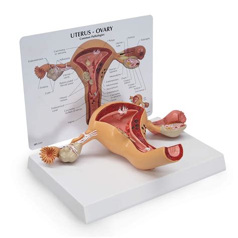 Buy Uterus & Ovary Model | Human Body Anatomy Replica of Female Reproductive System for Doctors ...