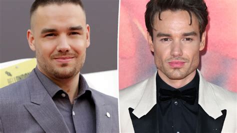 Liam Payne's Stunning Transformation: Facial Features Before and After ...