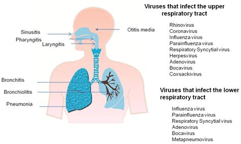 Pathogenesis of Viral Respiratory Infection | IntechOpen