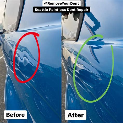 Seattle Paintless Dent Repair Services - Remove Your Dent