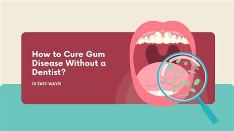 How to Cure Gum Disease Without a Dentist? 10 Easy Ways