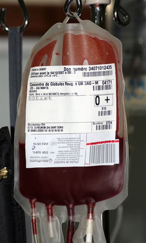 A Blood Transfusion for Anemia | Livestrong.com