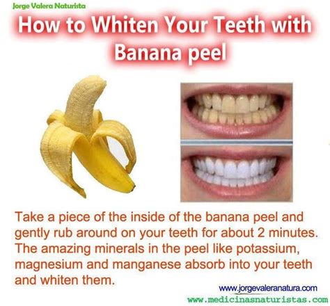 Rub banana peel against your teeth every day for amazing natural whitening results | Beauty ...