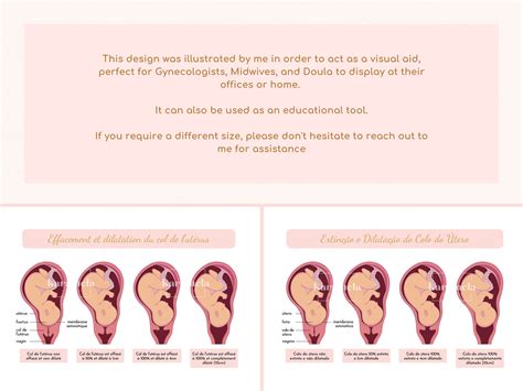 Printable Diagram of Cervical Effacement and Dilation Birth - Etsy UK