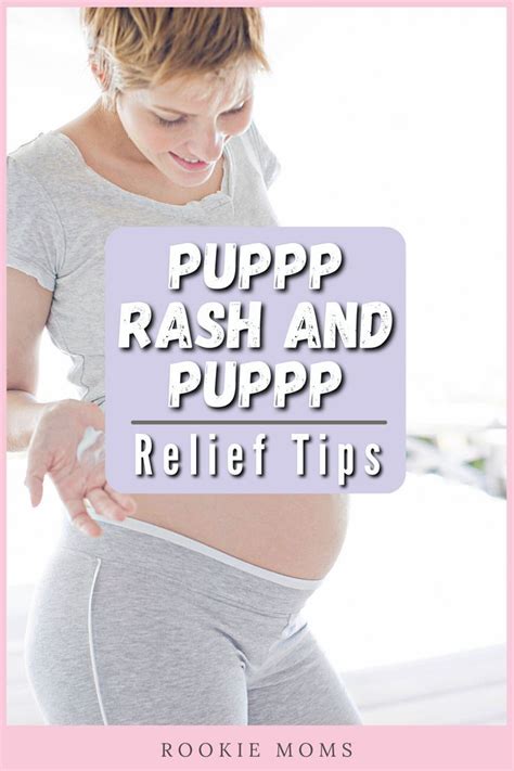 Everything to Know About PUPPP Rash and PUPPP Relief in 2024 | Heat rash, Stomach rash, Rookie moms