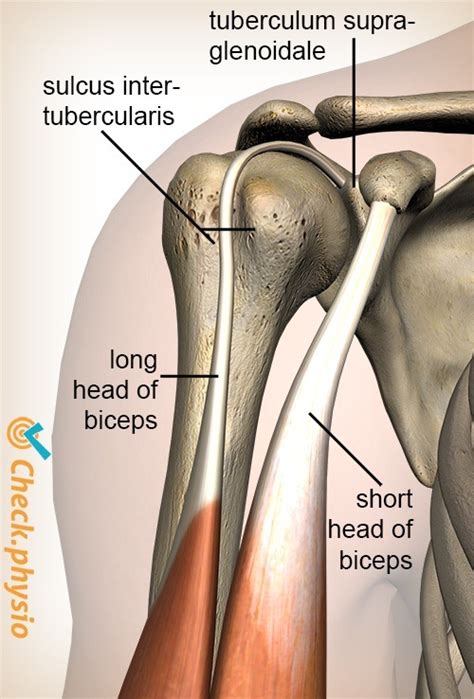 Proximal biceps injury | Physio Check