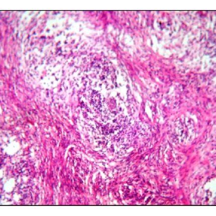 Histology of the omentum. (a) H&E ×100 magnification of omental tissue... | Download Scientific ...