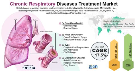 Chronic Respiratory Diseases Treatment Market Insight, Size, Share 2028