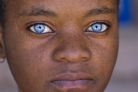 » Black People with Blue Eyes: Natural Phenomenon or Genetic Mutation?