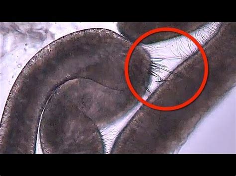 Jellyfish Stinging in MICROSCOPIC SLOW MOTION - Smarter Every Day 120 ...