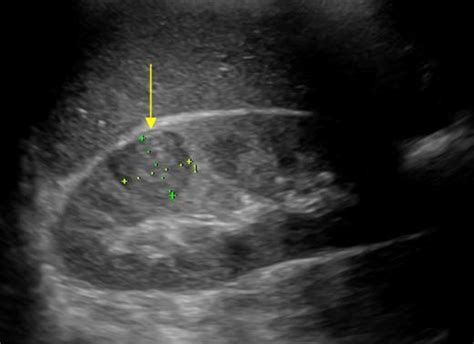 March 2012 | Ultrasound Cases