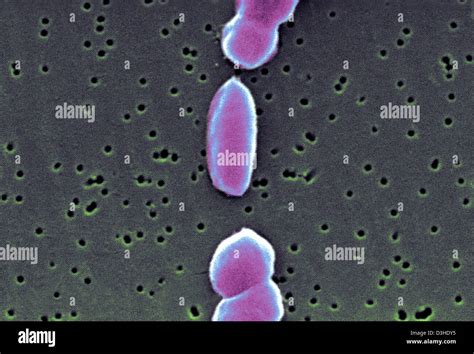 Vibrio parahaemolyticus hi-res stock photography and images - Alamy