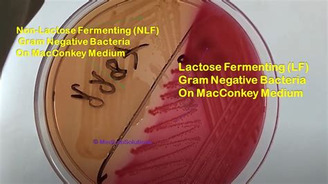 Lactose Fermenter and Non-lactose fermenter bacteria Demonstration ...