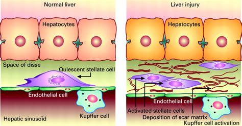 Stellate Cells Liver