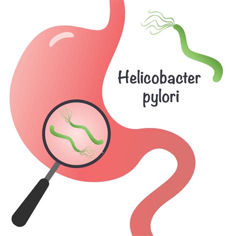 Vector Illustration Graphic of Helicobacter Pylori 9261691 Vector Art at Vecteezy