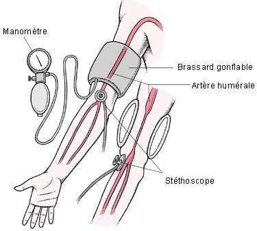 Comment prendre une tension artérielle avec un stéthoscope ? | Stéthoscope