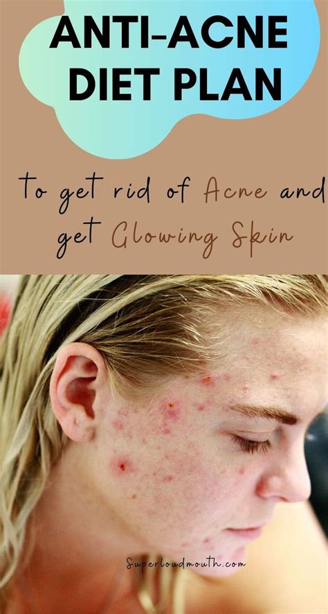 The Anti-Acne Diet: Diet and Nutrition tips for a Clear and Glowing Skin | Anti acne diet, Acne ...