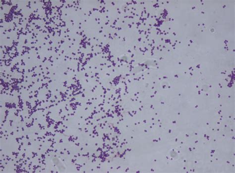 Staphylococcus saprophyticus - Microbiology - Medbullets Step 1