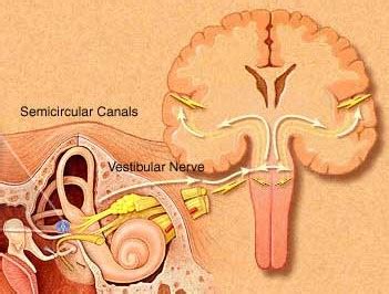 Vestibular Paroxysmia - Vestibular Disorders Association