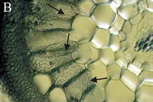 Ectomycorrhizas