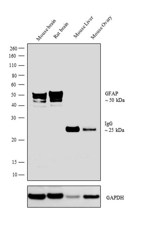 GFAP Antibody (MA5-15086)