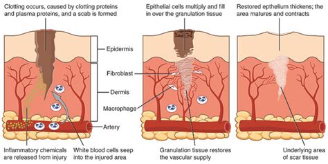 The Four-Stage Process of Wound Healing | Shop Wound Care