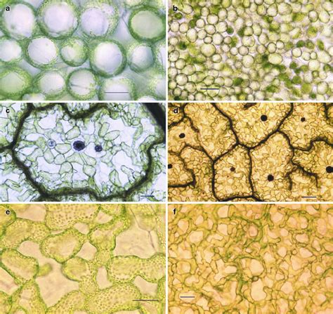 Light microscopic photomicrographs of Spinacia oleracea leaf fresh ...