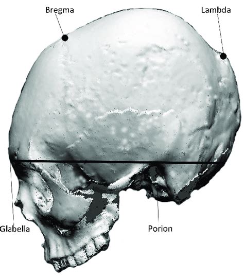 Bregma Skull