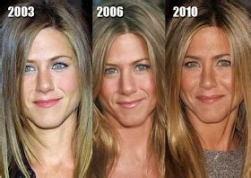 Famous for Plastic Surgery: Jennifer Aniston Plastic Surgery Eyelid ...