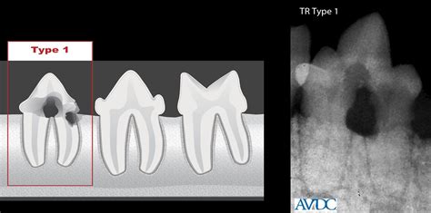 Tooth Resorption Cats Types - Cat Meme Stock Pictures and Photos