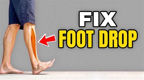 3 Exercises to Correct Foot Drop - YouTube
