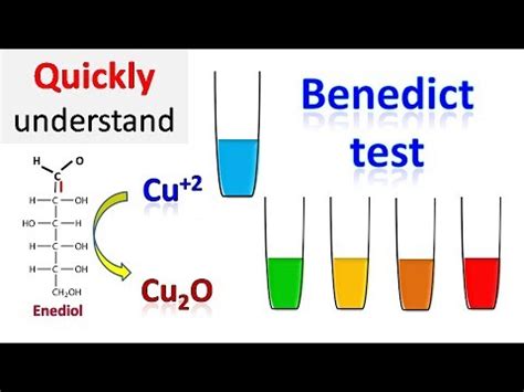 Benedict's test - YouTube