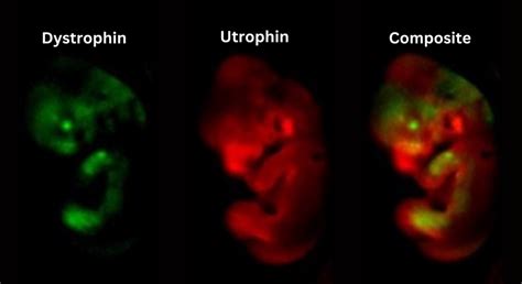 New Breakthrough in Duchenne Muscular Dystrophy Research