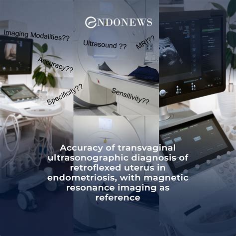 Transvaginal ultrasound or MRI for retroflexed uterus in endometriosis | EndoNews