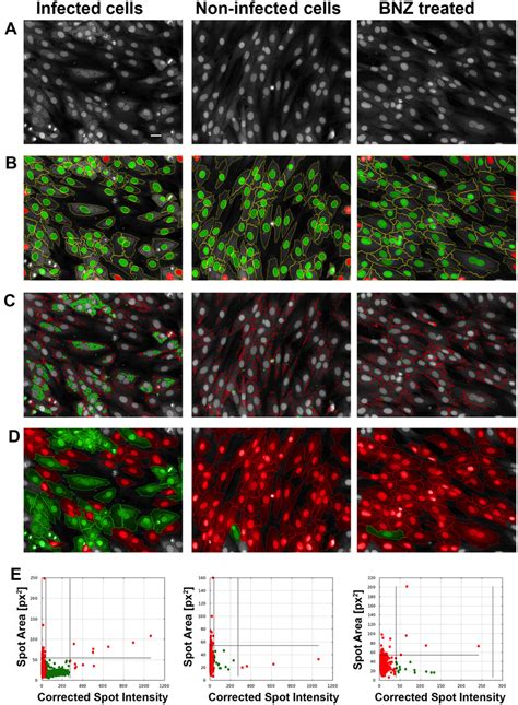 Image analysis development. Representative images of the T. cruzi... | Download Scientific Diagram