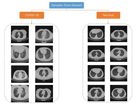 A Large Covid-19 CT Scans Dataset | by Mohammad Rahimzadeh | Medium