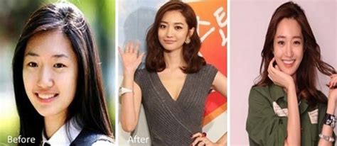 81 photos of plastic surgery in Korea that will make your jaw drop