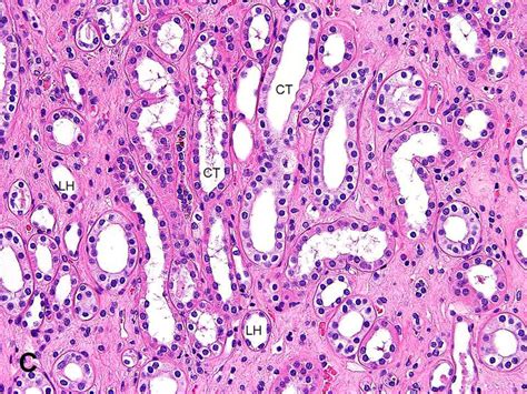 Collecting Ducts Kidney Histology