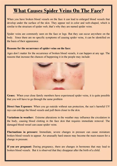 What Causes Spider Veins On The Face? by Alexander Perez - Issuu