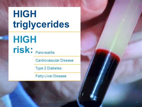 HIGH triglycerides Pancreatitis Cardiovascular Disease Type 2 Diabetes ...