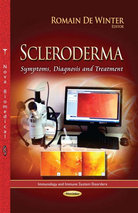 Scleroderma: Symptoms, Diagnosis and Treatment – Nova Science Publishers