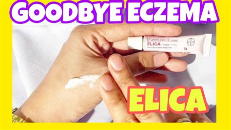 ELICA CREAM/ HOW TO APPLY CORRECTLY, FOR ECZEMA - YouTube