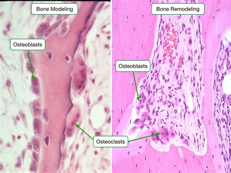 Bone Remodeling Histology