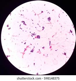 Gram Positive Cocci Bacteria Under 100x Stock Photo 598148375 ...