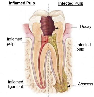 Pin on dental